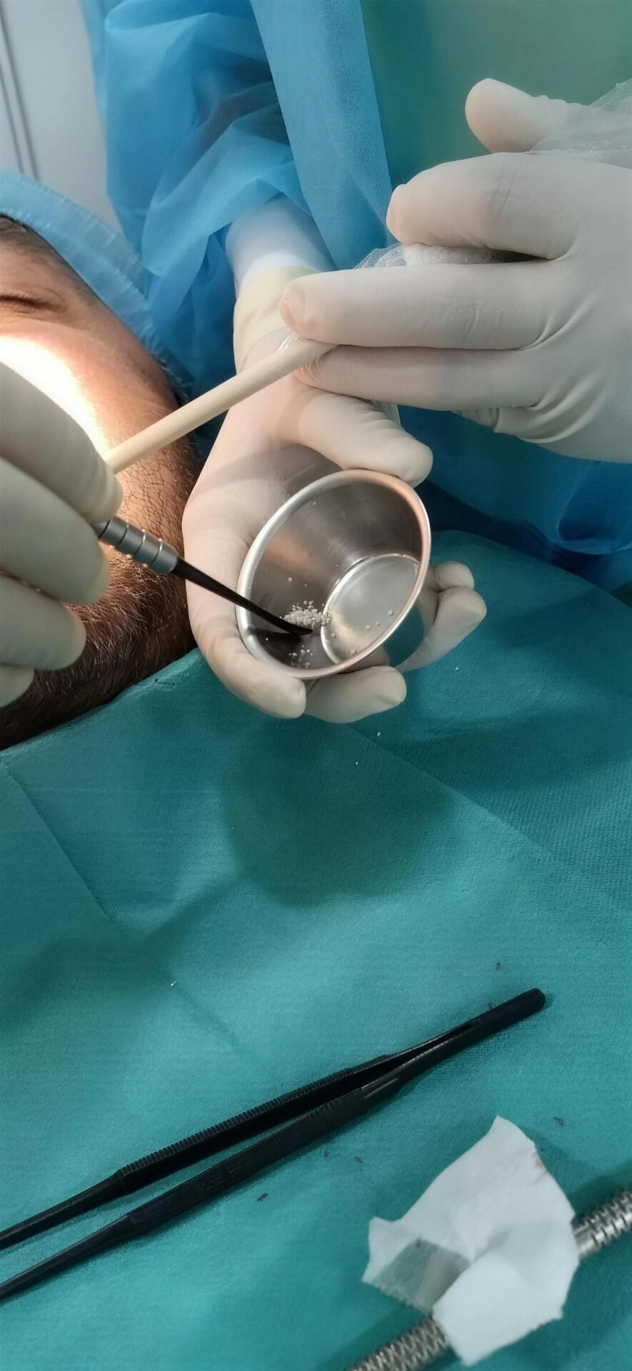 Material preparado con cuidado durante un tratamiento.